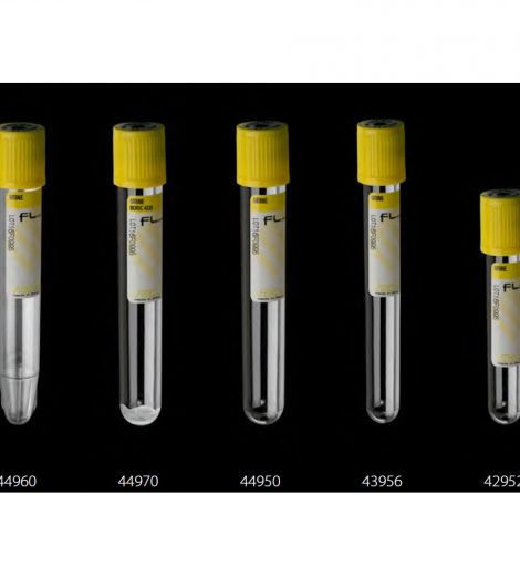 Vacutainer vacumed urină